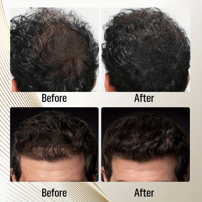 Adglamful Hair Building Fiber Powder - Instantly Thickens