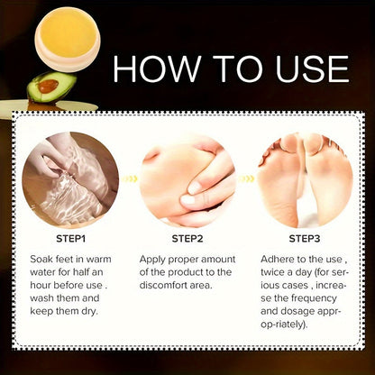 Cracked Heels Cream